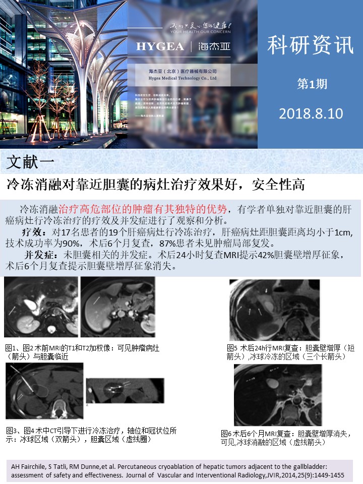 【海杰亞科研資訊】第1期——肝、肺癌消融